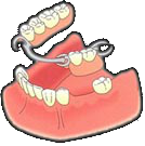 Partial Dentures